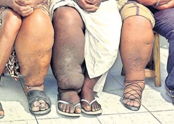 image editor output image1309685784 1711203044584